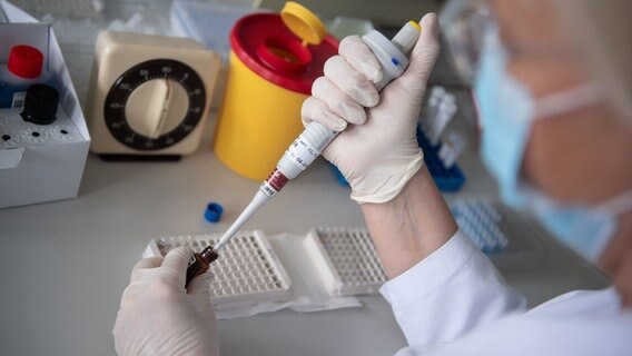Eine Mitarbeiterin testet Blutproben auf Antikörper. © picture alliance/Marijan Murat/dpa Foto: Marijan Murat