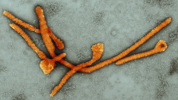Ebolaviren in 10.000-facher Vergrößerung unter dem Elektronenmikroskop. (Koloriert von Andrea Schnartendorff.) © Hans Gelderblom/RKI 