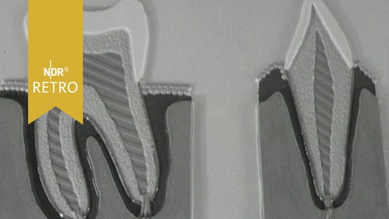 Schematische darstellung von Zähnen (1965)  