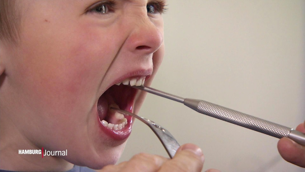 Ein Junge beim Zahnarzt.