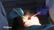 Die Zähne eines Kindes werden untersucht. © Screenshot 