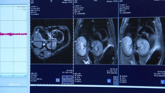 Röntgen-Aufnahmen auf einem Bildschirm. © Screenshot 