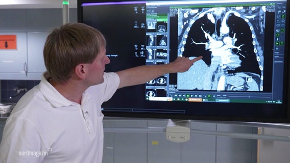 Ein Arzt zeigt in einem Katheterlabor auf einen Bildschrim auf dem ein diagnostisches CT-Bild einer Lungenarterien-Embolie gezeigt ist. © Screenshot 