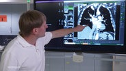 Ein Arzt zeigt in einem Katheterlabor auf einen Bildschrim auf dem ein diagnostisches CT-Bild einer Lungenarterien-Embolie gezeigt ist. © Screenshot 