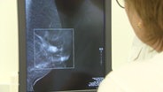 Eine Ärztin betrachtet das Röntgenbild einer weiblichen Brust und sucht nach Hinweisen auf Brustkrebs. © Screenshot 