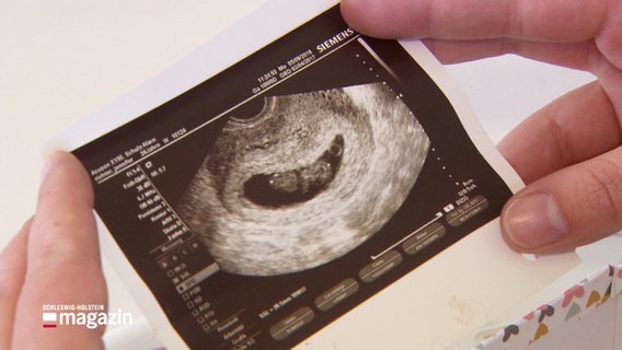 Eine Frau hält ein Ultraschallbild in den Händen. © Screenshot 