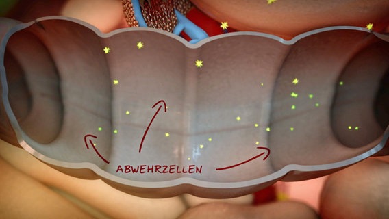 Schematische Darstellung: Abwehrzellen im Darm. © NDR 