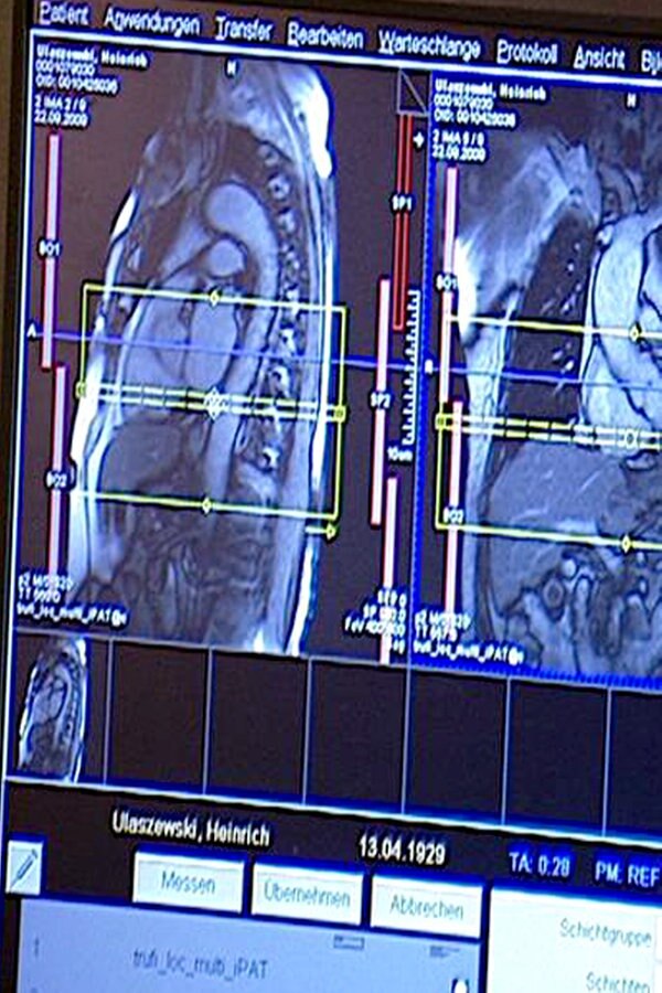 Herzdiagnostik Kernspin Statt Katheter Ndr De Ratgeber Gesundheit