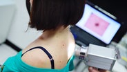 Bei einer Frau wird ein Hautscreening am Rücken durchgeführt. © Colourbox Foto: -