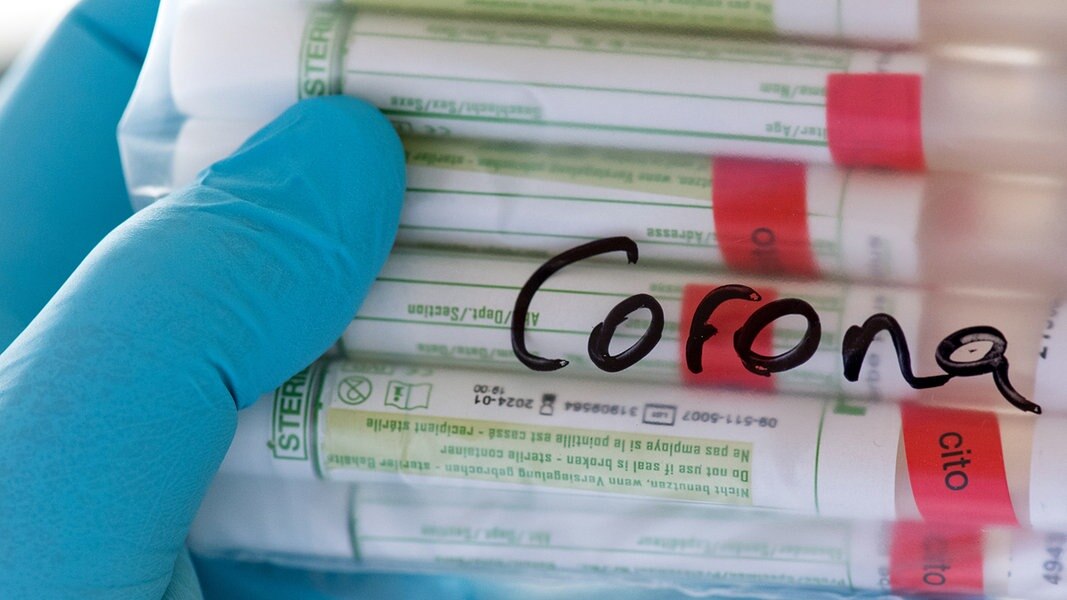 Corona News Ticker: 306 new infections registered in SH |  NDR.de – news