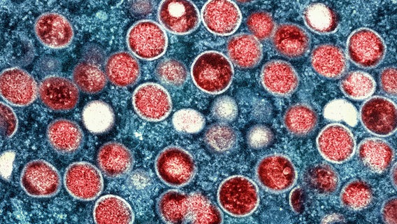 Kolorierte elektronenmikroskopische Aufnahme von Mpox-Partikeln (rot) in einer infizierten Zelle (blau). © picture alliance/dpa/National Institute of Allergy and Infectious Diseases/AP/Uncredited 