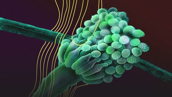 Schimmelpilz Aspergillus fumigatus © picture alliance 