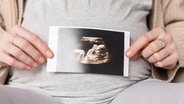Nahaufnahme einer schwangeren Frau mit Ultraschallbild. © picture alliance Foto: Oleksandr Latkun