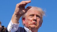 Der republikanische Präsidentschaftsbewerber und ehemalige US-Präsident Donald Trump mit blutendem Ohr © Evan Vucci/AP/dpa Foto: Evan Vucci
