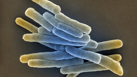 Mikroskop-Aufnahme des Tuberkulose-Erregers Mycobacterium tuberculosis (Kolorierung: Andrea Schnartendorff/RKI) © Gudrun Holland 2013/RKI 