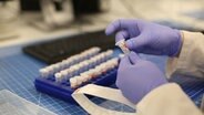 Ein PCR-Test wird bei der Firma Centogene in Rostock ausgeführt.  