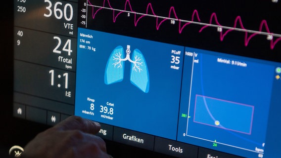 A doctor operates a ventilator in an intensive care unit.  © picture alliance Photo: Marijan Murat