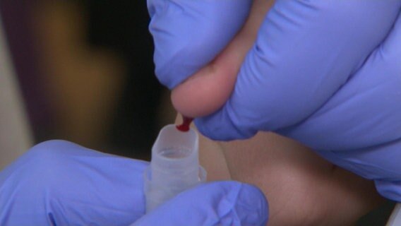 Ein Bluttropfen wird einem Kind abgenommen. Das Blut wird auf Schwermetalle untersucht. © NDR 
