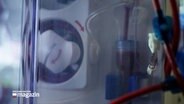 Ein Blick auf eine Dialyse-Maschine © NDR Foto: NDR Screenshot