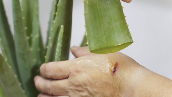 Eine Frau versorgt eine Wunde mit Saft aus einer Aloe Vera Pflanze. © imageBROKER/joseantona 