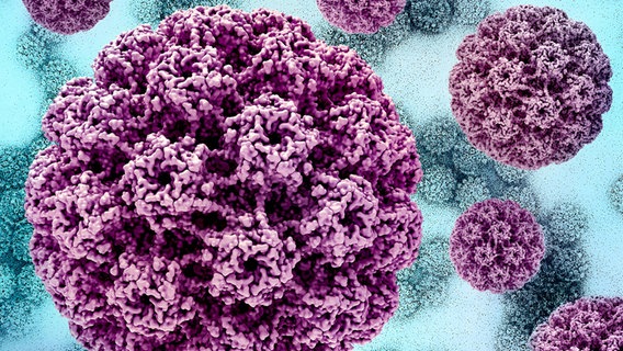 Computer Artwork: HP-Virus © IMAGO/ NIH-NIAID / IMAGE POINT FR / BSIP Foto: BSIP