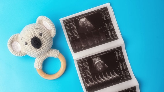 Auf einer hellblauen Oberfläche liegen ein Baby-Beißring mit einem gehäkelten Koala-Kopf und ein Streifen mit Ultraschallbildern eines Fötus. © Colourbox.de/Vlad Stenko Foto: Vlad Stenko