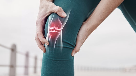 Meniskusriss: Frau fasst sich ans Knie, darüber liegt eine 3D-Grafik vom Kniegelenk © IMAGO / Zoonar Foto: Yuri Arcurs