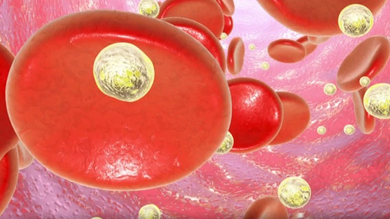 Nano-Partikel auf Blutkörperchen (Animation) © NDR 