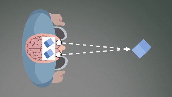 Schematische Darstellung Schielen, Bild 1: Das Gehirn "sieht" eigentlich zwei Bilder eines Gegenstandes © BR 