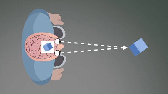 Schematische Darstellung Schielen, Bild 2: Das Gehirn sieht verbindet die zwei Bilder zu einem scharfen und dreidimensionalen Bild © BR Foto: x