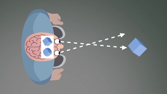 Schematische Darstellung Schielen: Das Gehirn sieht zwei Bilder, ein scharfes und ein unscharfes Bild © BR 