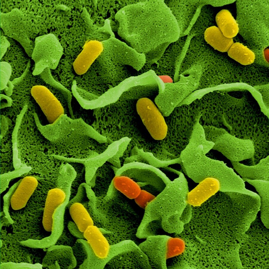 Listerien Wurst Kann Gefahrliche Bakterien Enthalten Ndr De Ratgeber Verbraucher